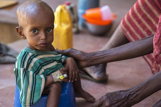 Somalidə 500 min uşaq ölüm riski ilə üz-üzədir