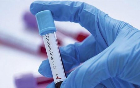 Türkiyədə ikinci koronavirusa yoluxma faktı aşkarlandı