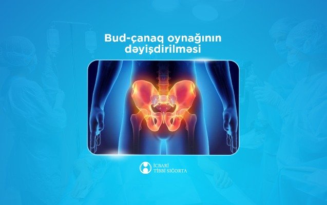 İTS bud-çanaq oynağının süni protezlə dəyişdirilməsi əməliyyatını qarşılayır 